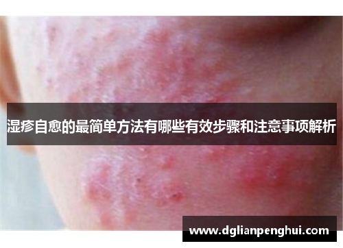 湿疹自愈的最简单方法有哪些有效步骤和注意事项解析